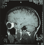 brain2.gif (6483 bytes)