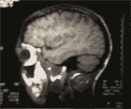 brain3.gif (4201 bytes)